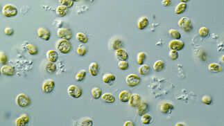 Mikroalgen mit grossem Potenzial